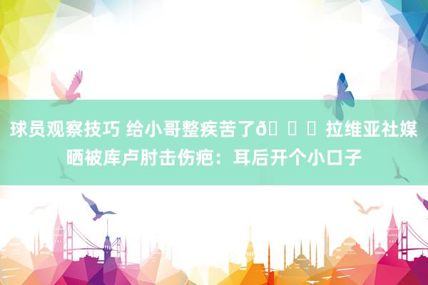 球员观察技巧 给小哥整疾苦了😅拉维亚社媒晒被库卢肘击伤疤：耳后开个小口子